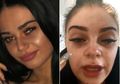 Perempuan Ini Buta Selama Dua Jam Setelah Menggunakan Bulu Mata Palsu, Kok Bisa?