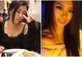 Wanita Cantik ini Ceritakan, 'Kehidupan Malamnya' Membuatnya Stroke di Usia 20-an