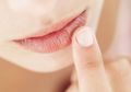 Cara Mengatasi Bibir Pecah-pecah dan Kering, Coba 5 Essential Oil Ini!
