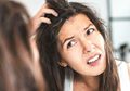 Berita Kesehatan Wanita: Cara Alami Mengatasi Ketombe, Hilang Dalam Sekejap!