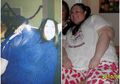 Tolak Operasi, Wanita Ini Berhasil Atasi Obesitas Ratusan Kilogram, Tampilannya Sekarang Bikin Pangling!