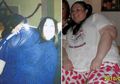 Tolak Operasi Untuk Obesitas, Perempuan ini Justru Jadi Woman Of The Year Slimming World 2018
