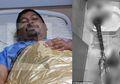 Kisah Atthaporn Boonmakchuay, Pria yang Tetap Selamat Meski Kemaluannya Digigit Ular Piton Saat Sedang Asyik BAB