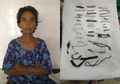 Derita Sindrom Achupagia, Dalam Benjolan Perut Wanita Ini Ada Puluhan Benda Logam Tajam