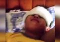 Guru Lalai, Puluhan Siswa SD Alami Luka Bakar dan Kerusakan Mata Karena Paparan Sinar Ultraviolet