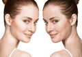 Simak 4 Trik Mudah Menutupi Jerawat Dengan Makeup yang Harus Kamu Tahu!