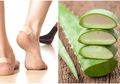 Kaki Lecet Karena Pakai Sepatu? Tenang, 7 Bahan Alami Berikut Bisa Mengatasinya