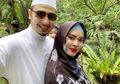 Jadi Istri Habib Usman, Pose Seksinya Dicibir, Kartika Putri: Bibir Dower Itu Pemberian Allah