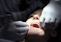 Wanita Cantik Ini Tak Gosok Gigi Selama 10 Tahun, Kondisi Giginya di Luar Dugaan