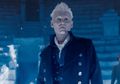 4 Aktor Hollywood Terkenal ini Ternyata Sempat Alami Depresi yang Mendalam