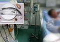 Gara-gara Makan 'Bagian Tubuh Ikan' Ini, Seorang Pria Alami Kerusakan Hati dan Gagal Ginjal Akut