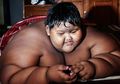 Turun 102 KG dengan Hanya Makan Lima Sendok dan Satu Lauk, Begini Penampilan Arya Permana, Bocah Obesitas 200 KG