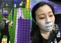 Niatnya Bermain Bisbol, Hidung Wanita Ini Malah Patah Terkena Bola dan Harus Membayar Rp 400 Juta untuk Biaya Medis