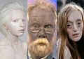 7 Orang dengan Kelainan Super Unik di Dunia yang Mungkin Hanya Bisa Kita Lihat Sekali Seumur Hidup
