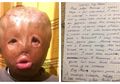 Seorang Anak Tulis Surat Memilukan untuk Santa, Ingin Dapatkan Wajah Baru