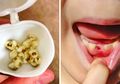8 Tips Perawatan Gigi dari Dokter Ini Tak Boleh Diabaikan, Perhatikan Baik-baik!