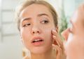 DIY Masker Buah-buahan Enak Ini untuk Kulit Kering dan Mengelupas