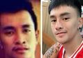 Terobsesi Ingin Mirip dengan Artis Korea Pria Ini Operasi Hingga 30 Kali, Seperti Ini Hasilnya