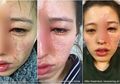 Gunakan Minyak Esensial, Wanita Ini Kaget Saat Pagi Hari Bercermin dan Melihat Wajahnya Terbakar!