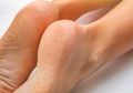 Ini Dia Tips Mengatasi dan Mencegah Kaki Kering dan Pecah-pecah