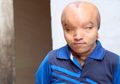 Kisah Menyedihkan Pria Berjuluk 'Alien' yang Ingin Dioperasi Karena Ingin Jatuh Cinta dan Menikah