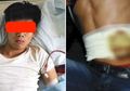 7 Tahun Lalu Jual Ginjal Demi Beli iPhone 4, Kondisi Kesehatan Pria Ini Sekarang Makin Parah