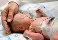 Kelahiran Prematur, Perhatikan Faktor Risiko yang Terjadi pada Bayi