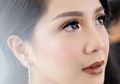 Selamat, 5 Letak Tahi Lalat di Wajah Ini Ungkap Keberuntungan!