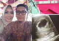 Istri Almarhum Bani Seventeen Unggah Foto USG Janinnya: 'Kali Ini Mami Ketemu Adek Cuma Sendiri', Buat Warganet Menangis