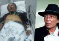 Renggut Nyawa Artis Senior Torro Margens, Makanan Favorit Semua Orang Ini Ternyata Bisa Picu Infeksi Lambung Kronis
