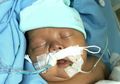 Berita Kesehatan Bayi: Kisah Perjuangan Ezra, Bayi Prematur Pengidap Bronchopulmonary Dysplasia