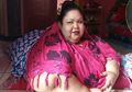 Berat Badan Titi Wati Capai 350 Kg, Ini 5 Orang Paling Gemuk Dalam Sejarah, 3 di Antaranya Sudah Meninggal