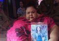 Kisah Titi Wati, Perempuan dengan Berat Badan 350 Kilogram Asal Kalimantan