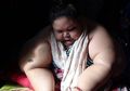 Pemadam Kebakaran Sampai Bobol Pintu dan Jendela untuk Angkat Dirinya, Titi Wati Bersiap untuk Jalani Operasi Ini