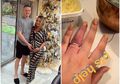 Sayang Sekali! Cincin Berlian Seharga Rp12 Miliar Harus Dipotong Karena Tak Bisa Dilepas dari Jari Manis Wanita Ini