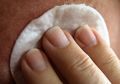 Hilangkan Komedo dalam Semalam dengan Cara Ini, Tak Usah Facial Mahal!