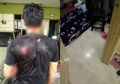 Seorang Tabib Tradisional Mengamuk Bak Orang Kesurupan, Serang Pasien dengan Parang Lalu Bunuh Diri