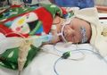 Bayi 24 Hari Meninggal karena Tak Dapat Jantung Baru: Bagaimana Proses Transplantasi Jantung?
