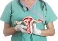 Perempuan Wajib Tahu 10 Tanda Kanker Ovarium, Salah Satunya Perut Kembung