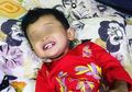 Digigit Serangga, Kaki Anak Ini Terinfeksi Bakteri Pemakan Daging dan Terancam Diamputasi