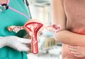 Waspada! Termasuk Kanker pada Organ Kewanitaan, Ini 6 Jenis Kanker yang Gejalanya Sulit Dideteksi