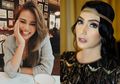Dari Aurel Hermansyah Hingga Tyas Mirasih, 5 Artis Indonesia Ini Tampil Imut dengan Gigi Kelinci Setelah Veneer Gigi