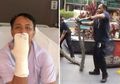 Amankan Ular Piton, Pria ini Justru Digigit hingga Gigi Hewan Tersebut Tertancap di Tangannya