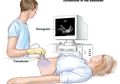 Hari Kanker Sedunia 2019: Mengenal Kanker Peritoneal, Diagnosis, dan Perawatannya