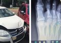 Ibu Ini Selamatkan Anaknya dalam Kecelakaan Mobil, Ini 4 Tips yang Harus Diketahui Setiap Orangtua
