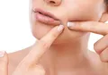 Mengapa Perempuan Punya Kebiasaan Memencet Jerawat? Rupanya Ada Alasan Psikologisnya