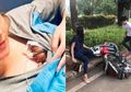 BERITA POPULER: Kisah Bayi Terkecil Lahir dengan Berat 0,7 Kg Hingga Yuni Astuti, Pacar Cowok yang Ngamuk Saat Ditilang Masih Mau Dinikahi