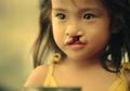 Dibuang Orangtuanya Karena Terlahir Sumbing, Anak ini Justru Tumbuh dengan Cantik