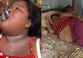 Badan Kurus Dinilai Nggak Menarik, Desa Ini Anggap Cewek Obesitas Sebagai Primadona