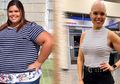 Turunkan Berat Badan Hingga 77 Kg, Wanita Ini Malah Idap Kanker, Begini Fakta di Baliknya
